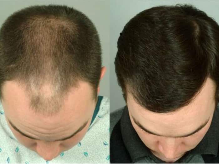 Easy home made hair mask