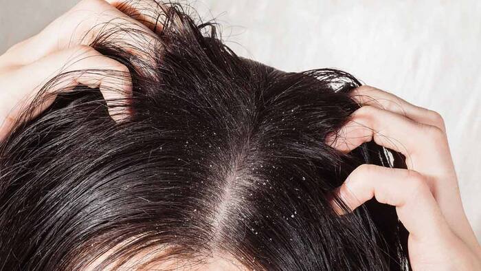 Causes of hair fall