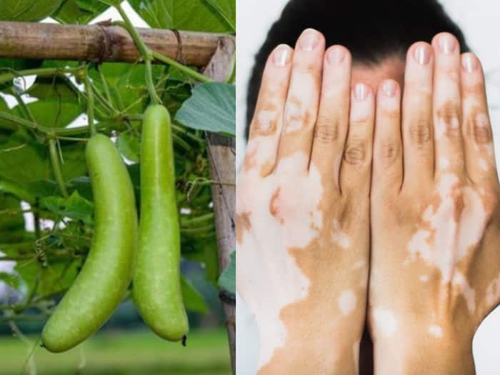 Gheeya skin patches images