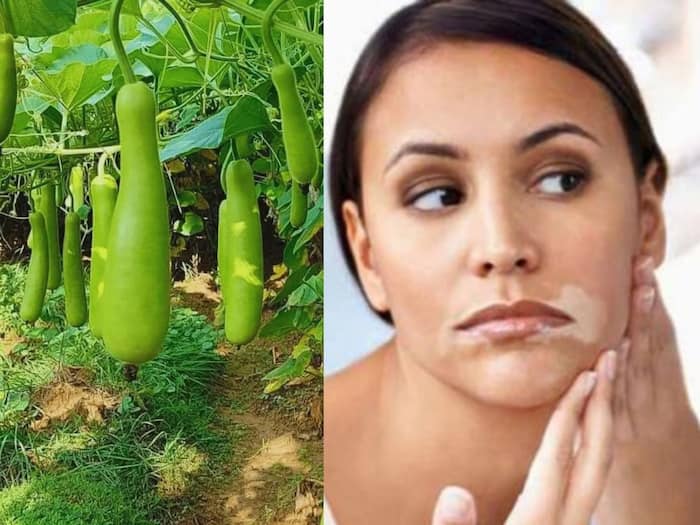 Skin patches bourd gourd