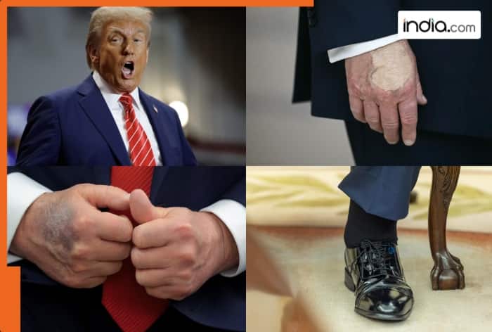 Donald Trump, aspirin, blood, Donald Trump Health Update, Walter Reed National Military Medical Center, Sean Barbabella, Karoline Levitt, White House