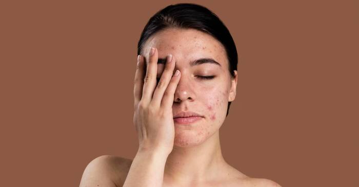 Homemade night serum for glowing skin
