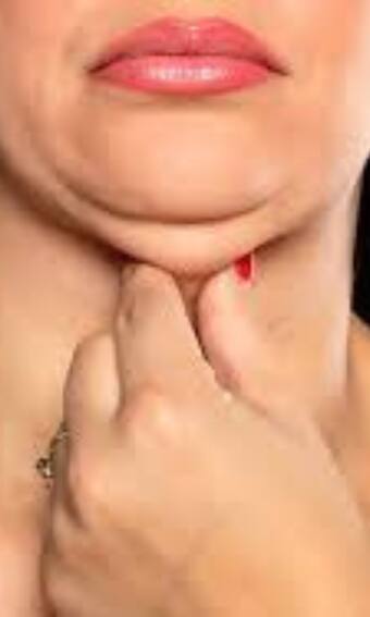 डबल चिन को कैसे कम करें?