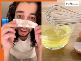 अब नहीं पडे़गी पार्लर जाने की जरूरत, सिर्फ 1 अंडे और टिशू की मदद से घर पर ही निकल जाएंगे सारे ब्लैकहेड्स !