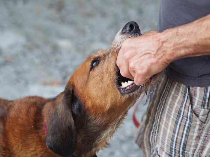 What to do immediately after dog bite
