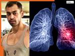 पोस्टमार्टम रिपोर्ट में हुआ खुलासा, लंग्स की इस बीमारी ने ली प्रतीक यादव की जान! ये लक्षण दिखने पर आप भी तुरंत हो जाएं सावधान