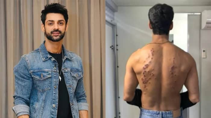 Khatron Ke Khiladi 15: Karan Wahi talks about intense pellet gun task, reveals its impact on him, 'After the first bullet...'