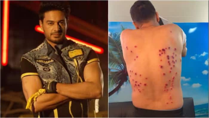 Khatron Ke Khiladi Season 15: Gaurav Khanna shows brutal stunt injuries, fans worried after seeing rubber bullet marks- Watch Video