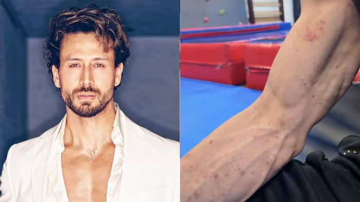 Tiger Shroff’s team posts video of red marks on his arms amid ongoing firing investigation