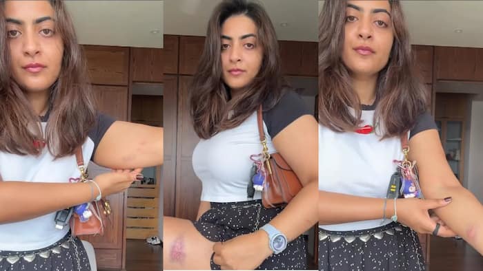 Aamir Khan's niece Zayn Marie shows injury marks on her arms and legs after detention in Mumbai during Kranti Maidan protest - Watch video